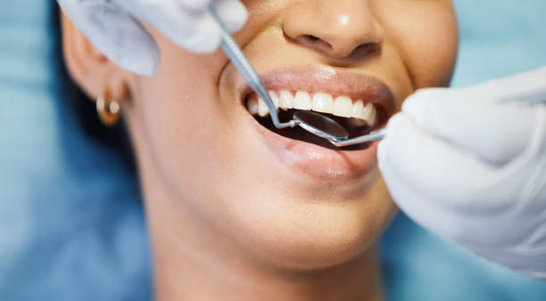 Best Walk-In Emergency Dentist in Elkhorn, CA